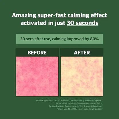 Mediheal Teatree Calming Moisture Ampoule Skincare Blemish