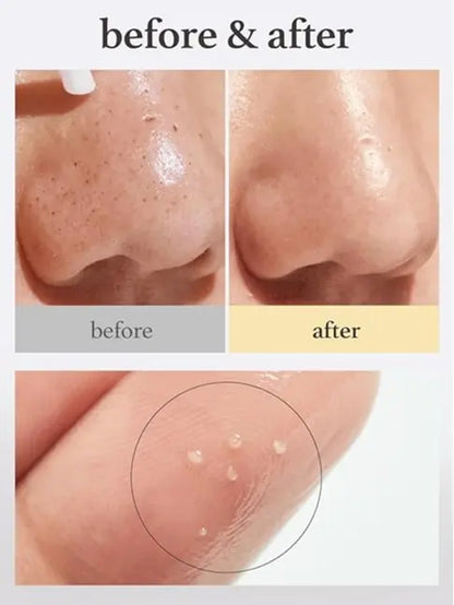 NOONI Korean Cleansing Oil - Snow Aqua 0 LHA Toning Pore Care Korean Facial Oil Cleanser, 6.76 Fl.Oz | Makeup Double Cleansing, Glass Skin, Eggie Skin, Blackhead Control, Pore Cleansing Oil for Face Makeup Remover Clear