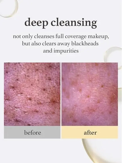 NOONI Korean Cleansing Oil - Snow Aqua 0 LHA Toning Pore Care Korean Facial Oil Cleanser, 6.76 Fl.Oz | Makeup Double Cleansing, Glass Skin, Eggie Skin, Blackhead Control, Pore Cleansing Oil for Face Makeup Remover Clear