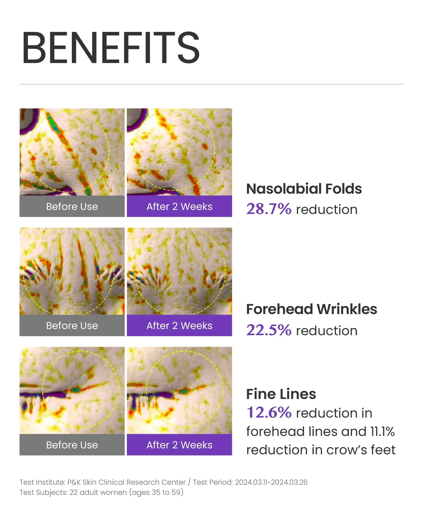 DOMINAS Atclinic Volufiline Wrinkle Shot Serum with 5% Volufiline & E-PDRN for Korean Skin Repair Reducing Wrinkles in 2 Weeks