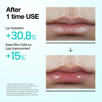 [Anua Official] PDRN Lip Serum 10Ml L All Day Hydrating Lip Serum, Salmon PDRN Collagen, Plumping, Long-Lasting Moisturizing, Dry Lips Treatment