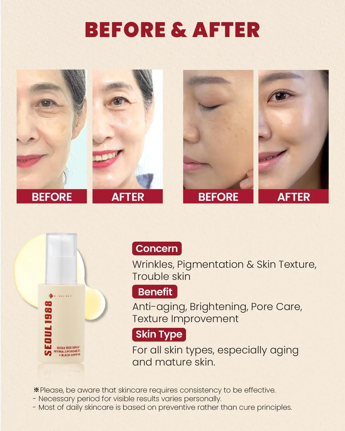 KSECRET SEOUL 1988 Serum : Retinal Liposome 2% + Black Ginseng, 30Ml/1.01Fl.Oz | 58% Black Ginseng Extract | Retinal Serum, Bakuchiol, Vitaminc&3Peptides for Wrinkle Care | Korean Skincare | Seoul1988 Comfort Nourishing Skin Repair