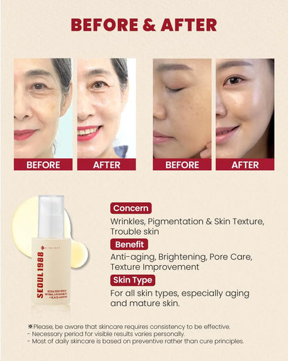 KSECRET SEOUL 1988 Serum : Retinal Liposome 2% + Black Ginseng, 30Ml/1.01Fl.Oz | 58% Black Ginseng Extract | Retinal Serum, Bakuchiol, Vitaminc&3Peptides for Wrinkle Care | Korean Skincare | Seoul1988 Comfort Nourishing Skin Repair
